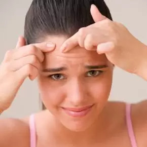 Dermatologist-guided acne treatment options