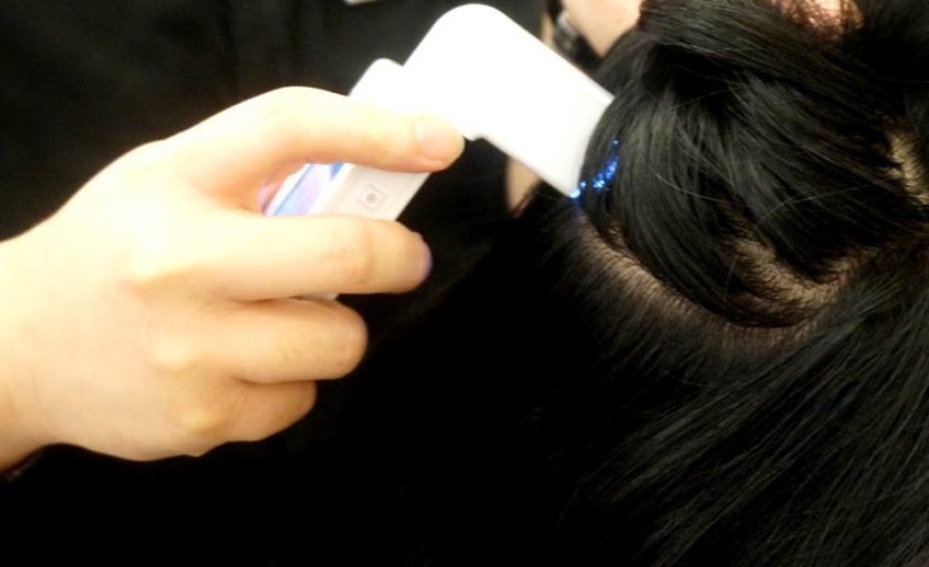 Secret Hair Story Scan Hair Scan in Chennai - Hair Scan to Diagnose Hair Fall Causes