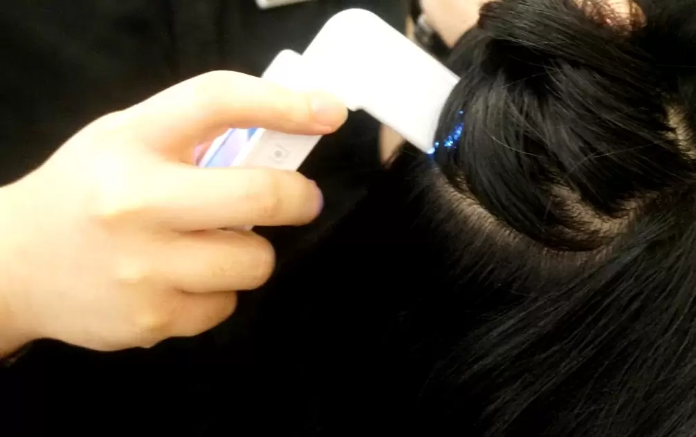 Hair and Scalp Assessment in Chennai