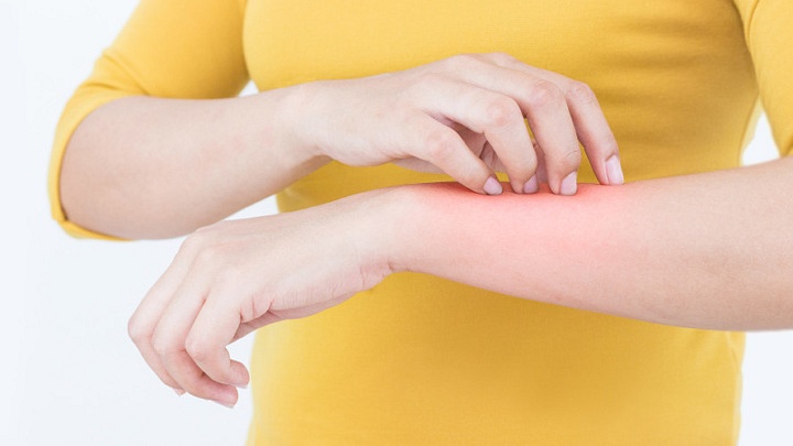 Psoriasis Treatment in Chennai | Treatment for Psoriasis in Chennai