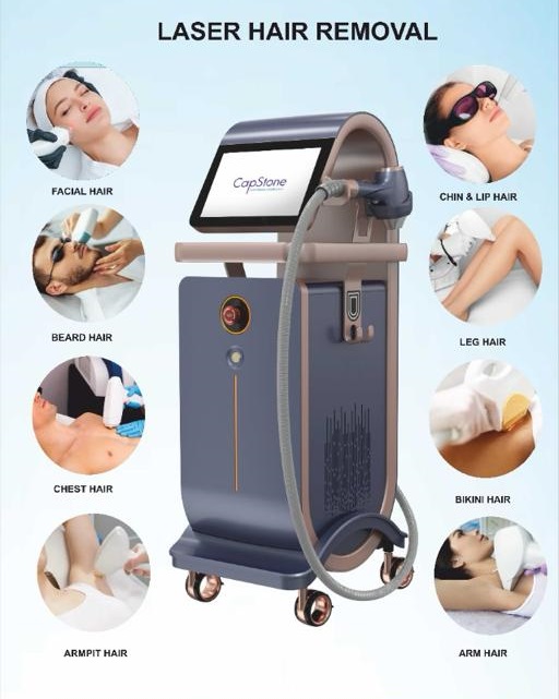 Painless Laser Hair removal machine